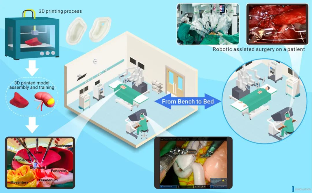  ロボット支援手術と 3D プリントモデル